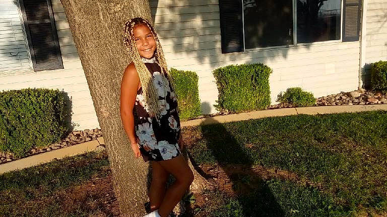 Kreelynn is registered to the contest to win money with this photo: cool, eyewear, fawn, flash_photography, grass, hair, human_leg, joy, lawn, leaf, leisure, long_hair, luggage_and_bags, people_in_nature, person, plant, shoulder, street_fashion, sunlight, thigh