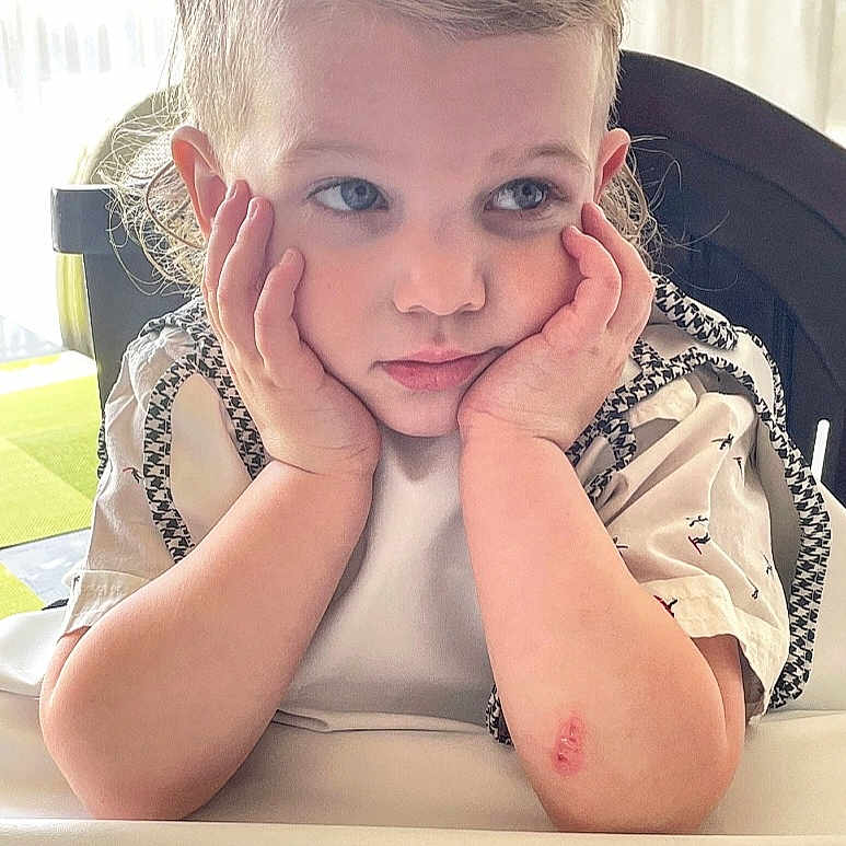 Robbie joined the competition — help win amazing prizes! arm, blue_eyes, child, cute, expression, face, hair, hands, high_chair, indoor, natural_light, pensive, person, portrait, scrape, seated, shirt, skin, toddler, young