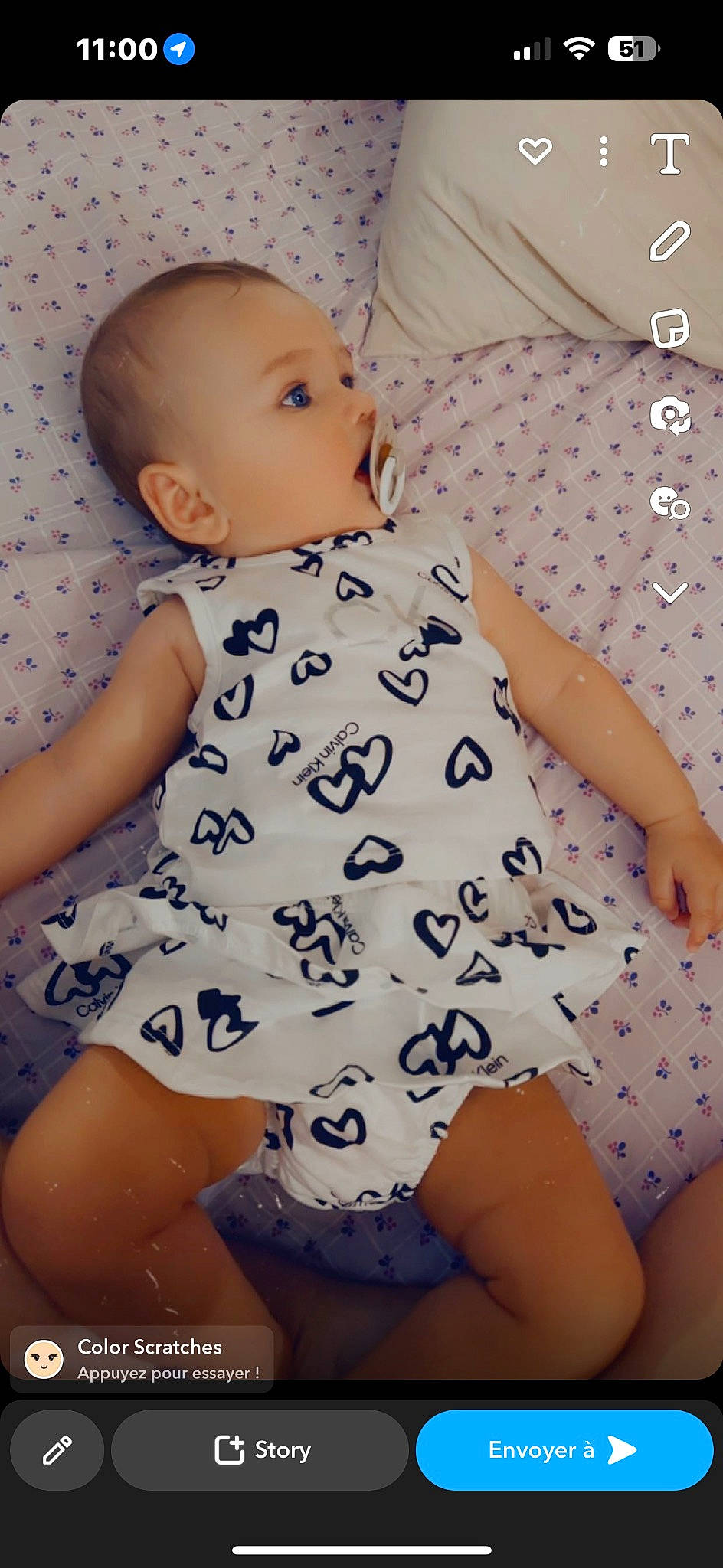 Yeimy participe au concours pour gagner de l'argent avec cette photo : baby, baby_toddler_clothing, blond, cheek, child, comfort, finger, head, human_leg, joint, knee, neck, pattern, person, shoulder, sitting, skin, sleeve, textile, thigh