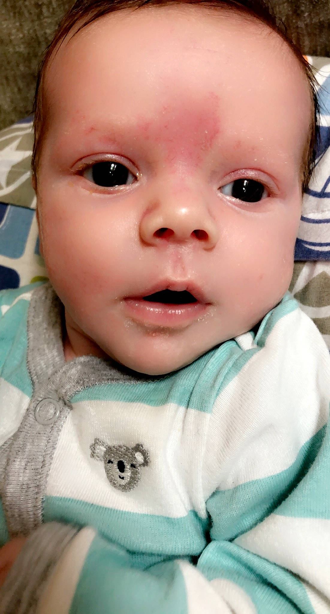 Cian joined the competition — help win amazing prizes! baby, baby_making_funny_faces, cheek, child, chin, close_up, eye, eyebrow, eyelash, face, facial_expression, forehead, head, iris, lip, mouth, nose, person, skin, smile