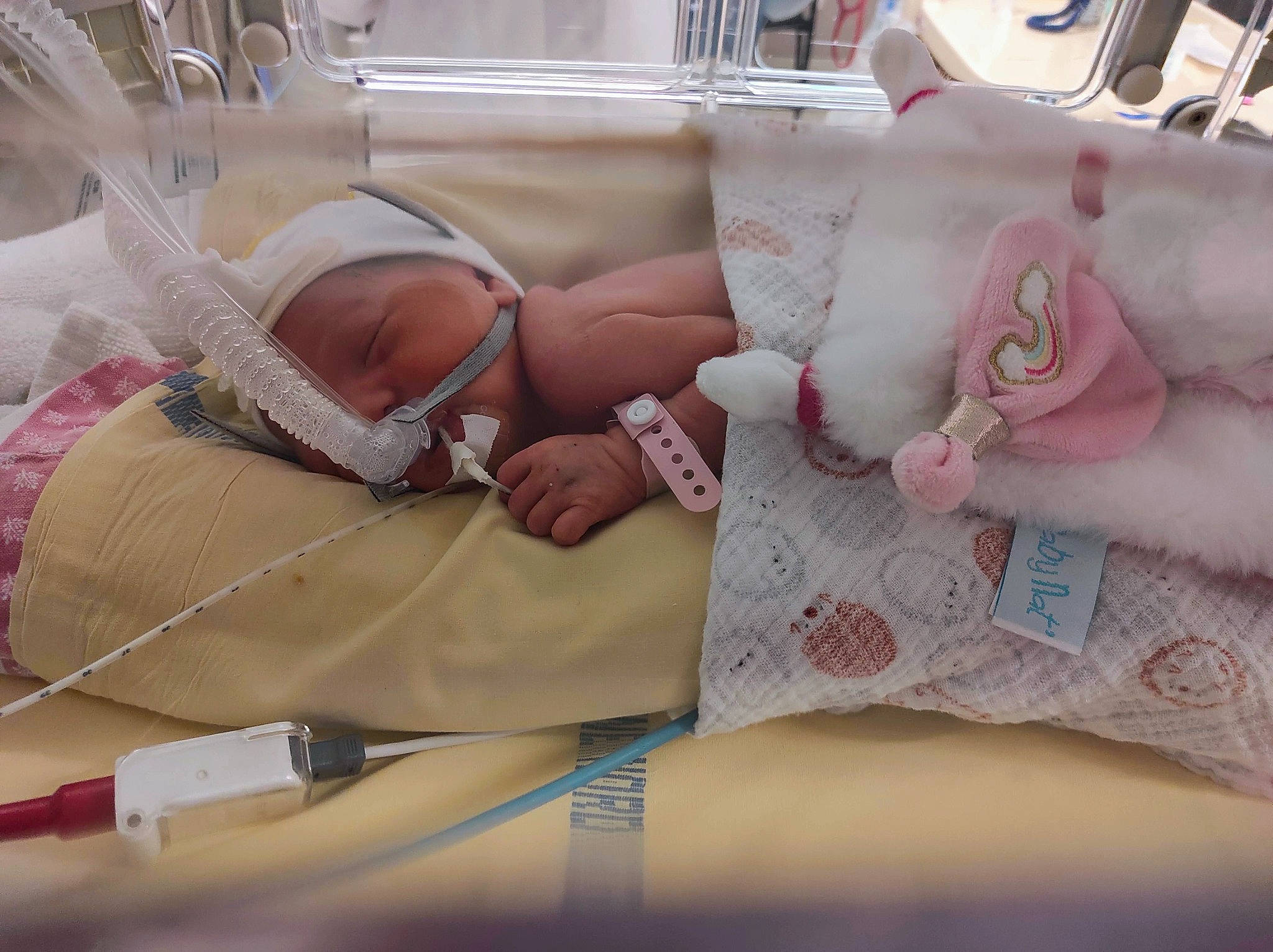 Isy participe au concours pour gagner de l'argent avec cette photo : abdomen, art, baby, bed_sheet, bedding, child, comfort, event, flesh, health_care, leg, linens, medical, medical_equipment, medical_procedure, patient, pattern, person, service, skin