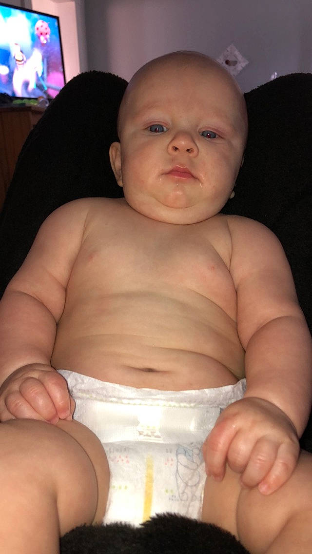 Dominik joined the competition — help win amazing prizes! abdomen, baby, cheek, chest, child, diaper, eye, finger, hand, mouth, muscle, person, skin, stomach, thumb, toddler, trunk