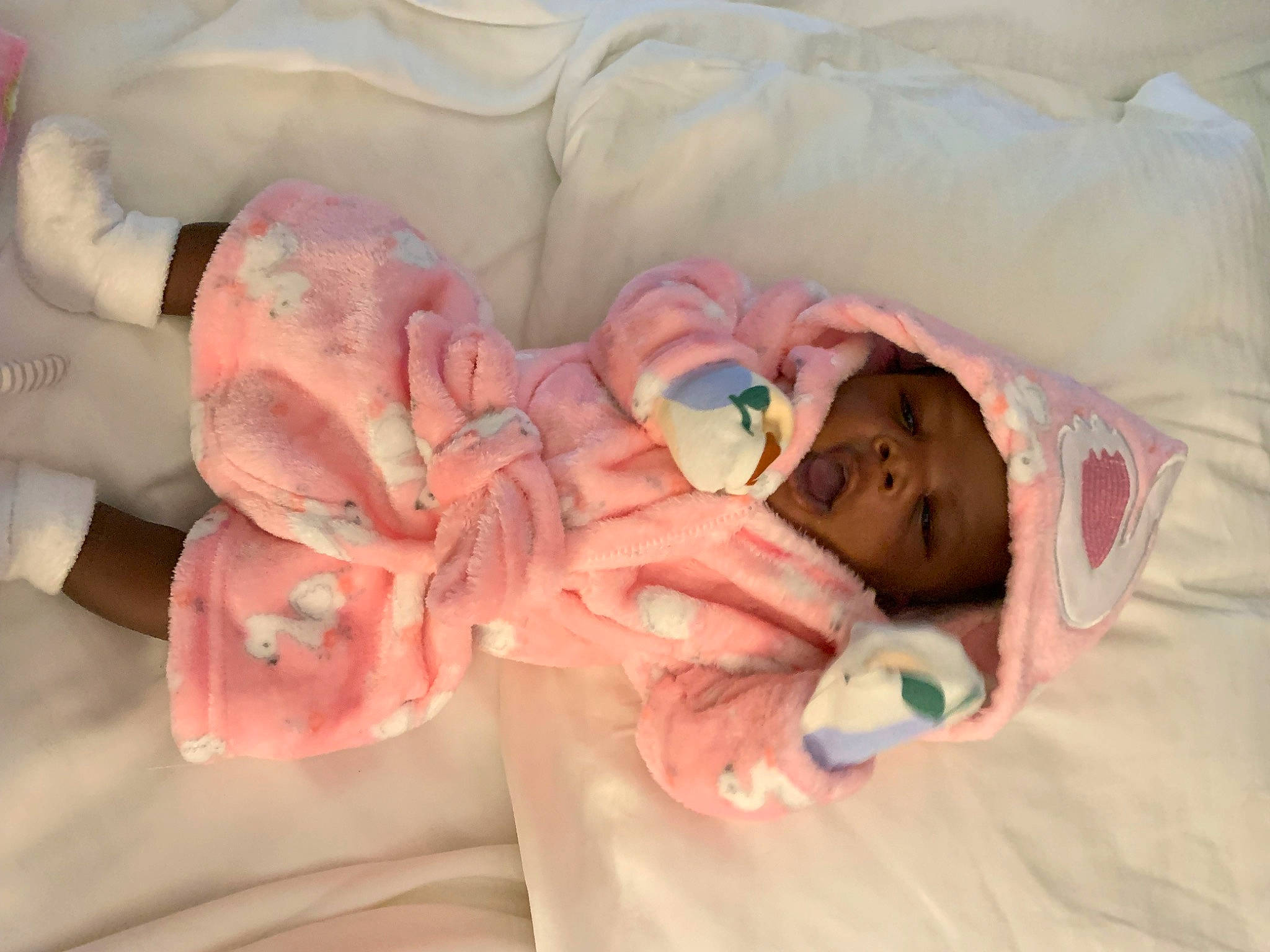 Kemyiah is registered to the contest to win money with this photo: arm, baby, baby_products, baby_sleeping, baby_toddler_clothing, bedtime, child, childbirth, comfort, gesture, headwear, health_care, linens, medical_procedure, nail, peach, person, pink, room, skin