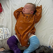 Owen is registered to the contest to win money with this photo: baby, sleeping, cast, leg_cast, orange_outfit, bed, blanket, diaper, infant, resting, soft_fabric, patterned_clothing, purple_cast, blue_cast, newborn, cute, child, indoors, comfort, relaxation