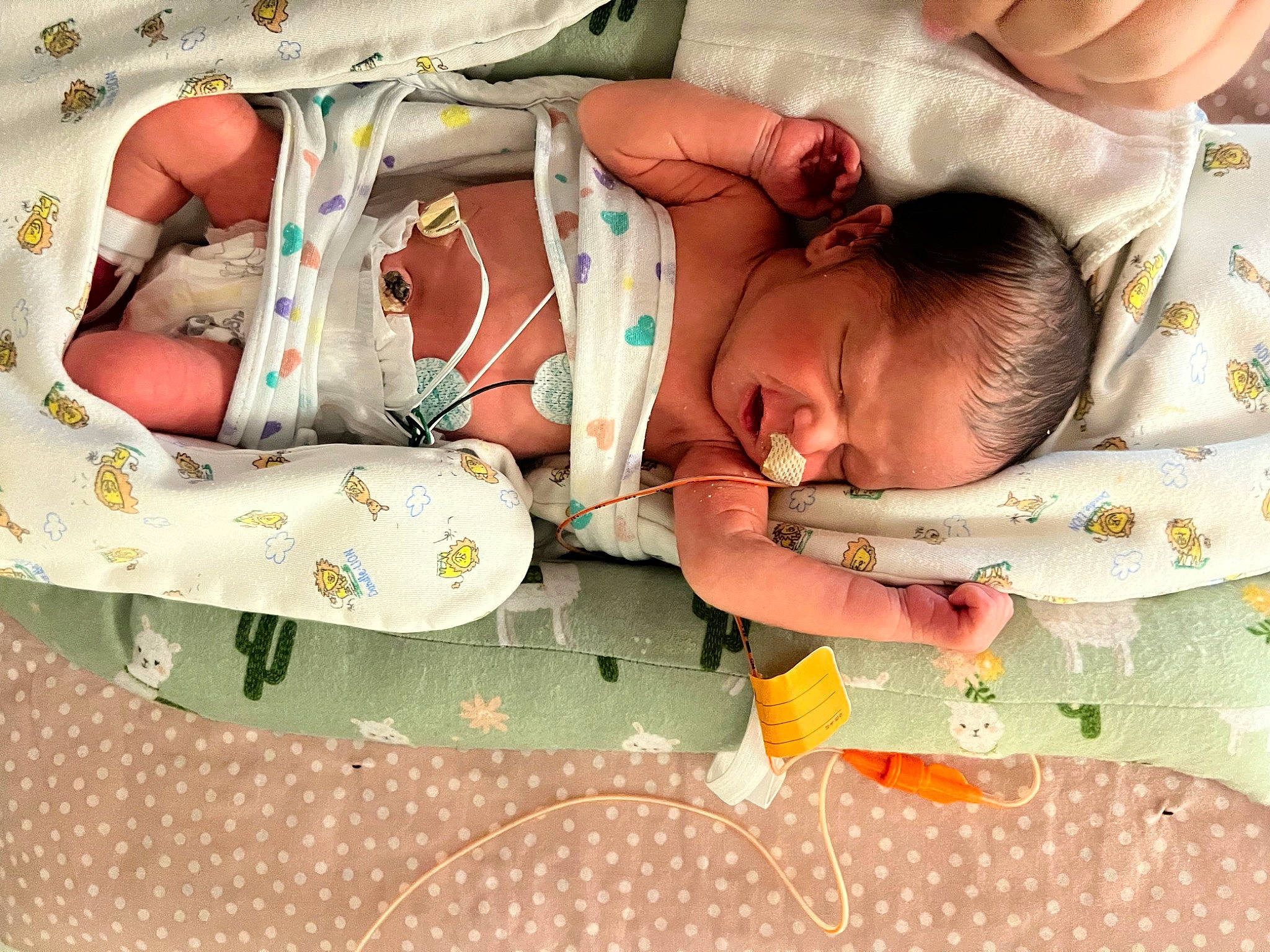 Layne is registered to the contest to win money with this photo: abdomen, baby, baby_products, baby_sleeping, baby_toddler_clothing, bedtime, child, comfort, hand, health_care, hospital, linens, medical_equipment, medical_procedure, patient, pattern, person, room, skin, textile