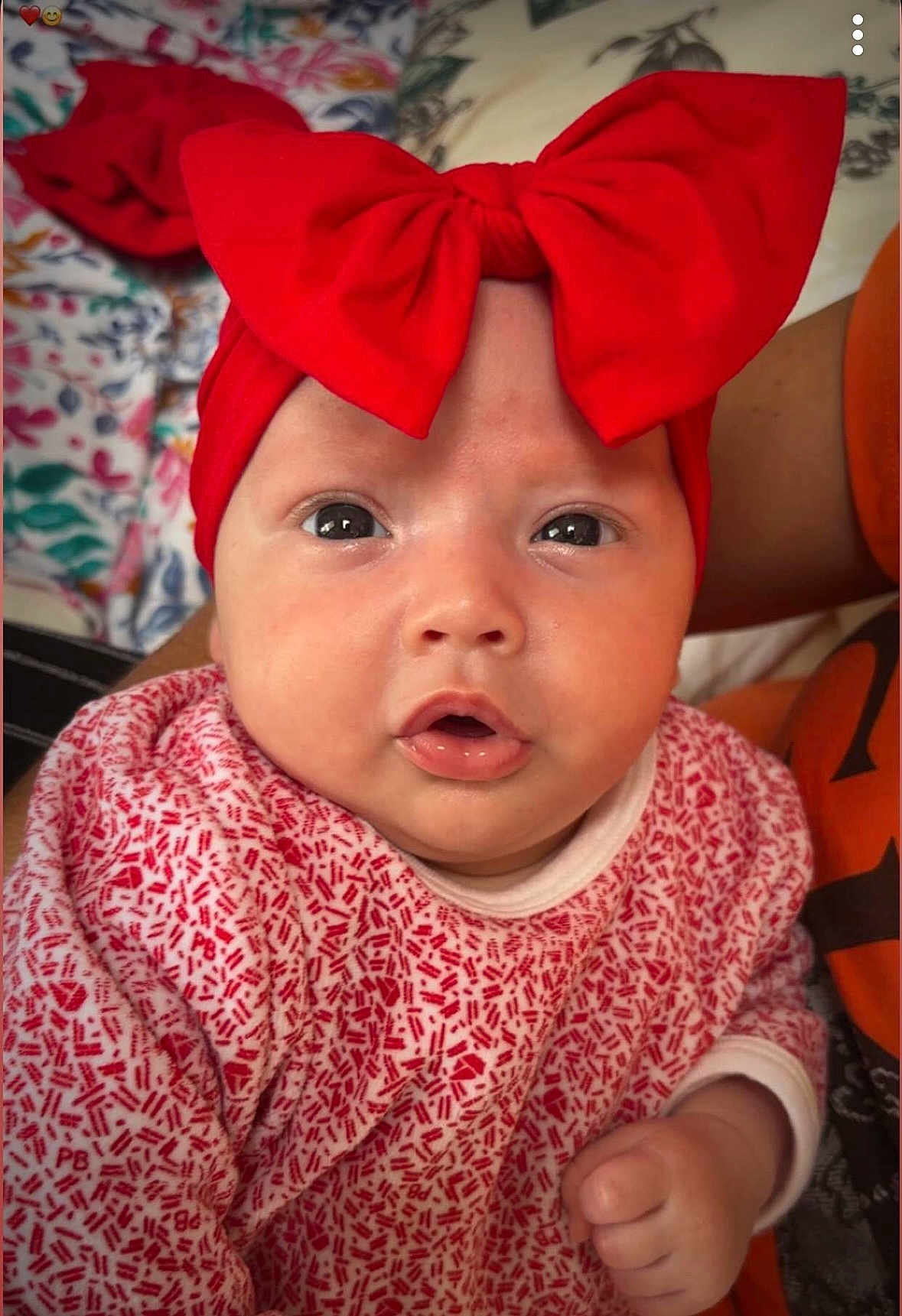 Rubby a rejoint le concours — aidez-le/la à gagner de superbes lots ! baby, infant, face, headband, red_bow, clothing, patterned_outfit, skin, hand, expression, indoor, person, cute, adorable, child, portrait, young, newborn, curious, closeup