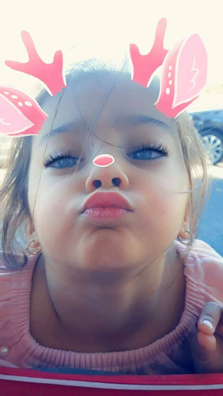 Anna a rejoint le concours — aidez-le/la à gagner de superbes lots ! cheek, child, ear, face, forehead, head, lip, nose, person, photography, pink, skin