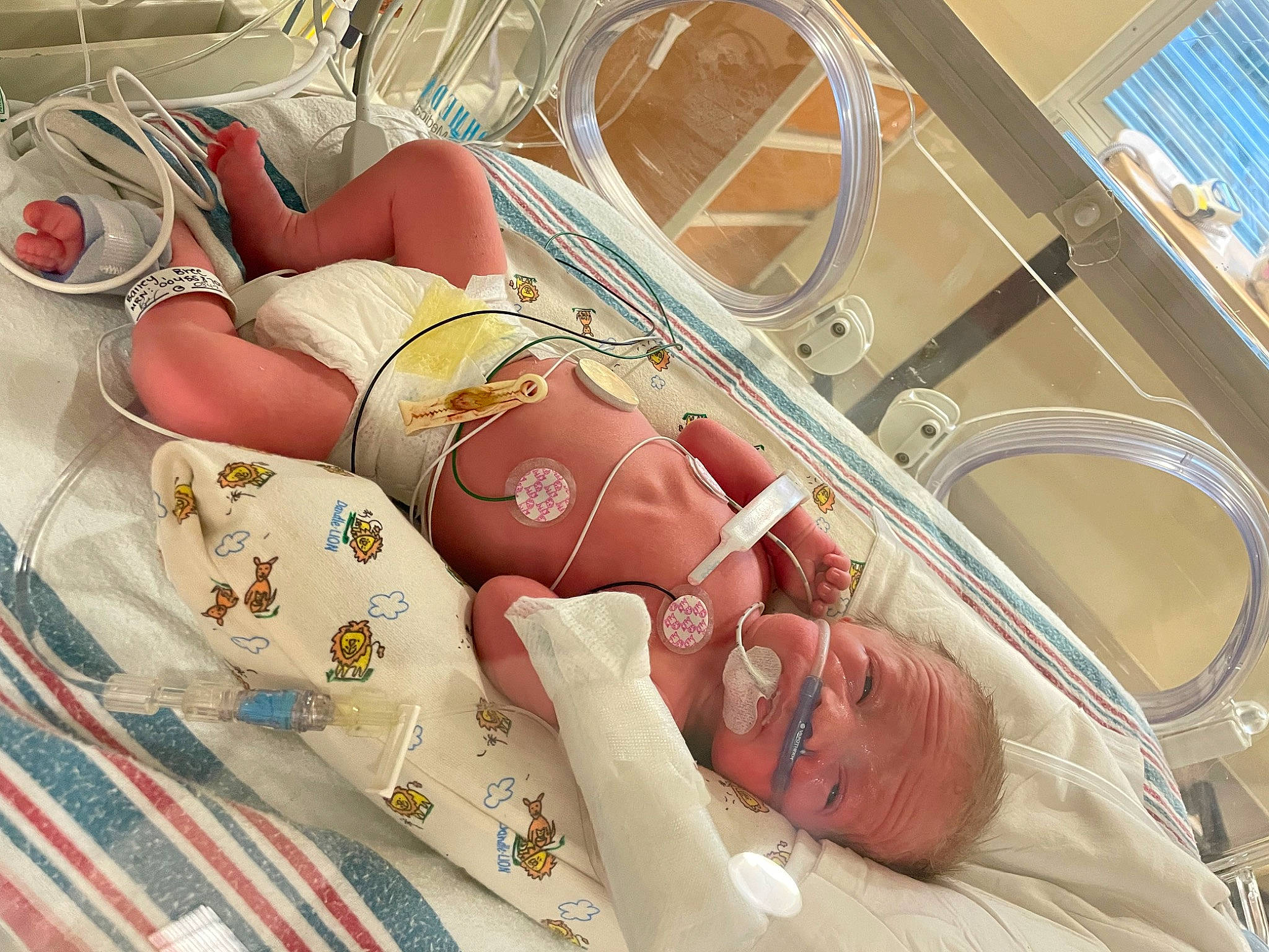 Canaan joined the competition — help win amazing prizes! baby, comfort, event, flesh, hospital, human_leg, linens, medical_equipment, medical_procedure, patient, peach, person, room, science, service