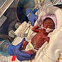 premature_baby, incubator, hospital, medical_tubes, gloved_hands, blanket, diaper, neonatal_care, baby_hat, fragile, newborn, patient, healthcare, medical_equipment, caregiver, tiny_baby, hospital_bed, infant, life_support, medical_tape