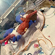 Santiago joined the competition — help win amazing prizes! premature_baby, neonatal_incubator, hospital, medical_equipment, gloved_hands, tubes, blanket, newborn, infant, medical_care, tiny, fragile, diaper, patient, healthcare, bed, clamp, monitoring, sterile, care