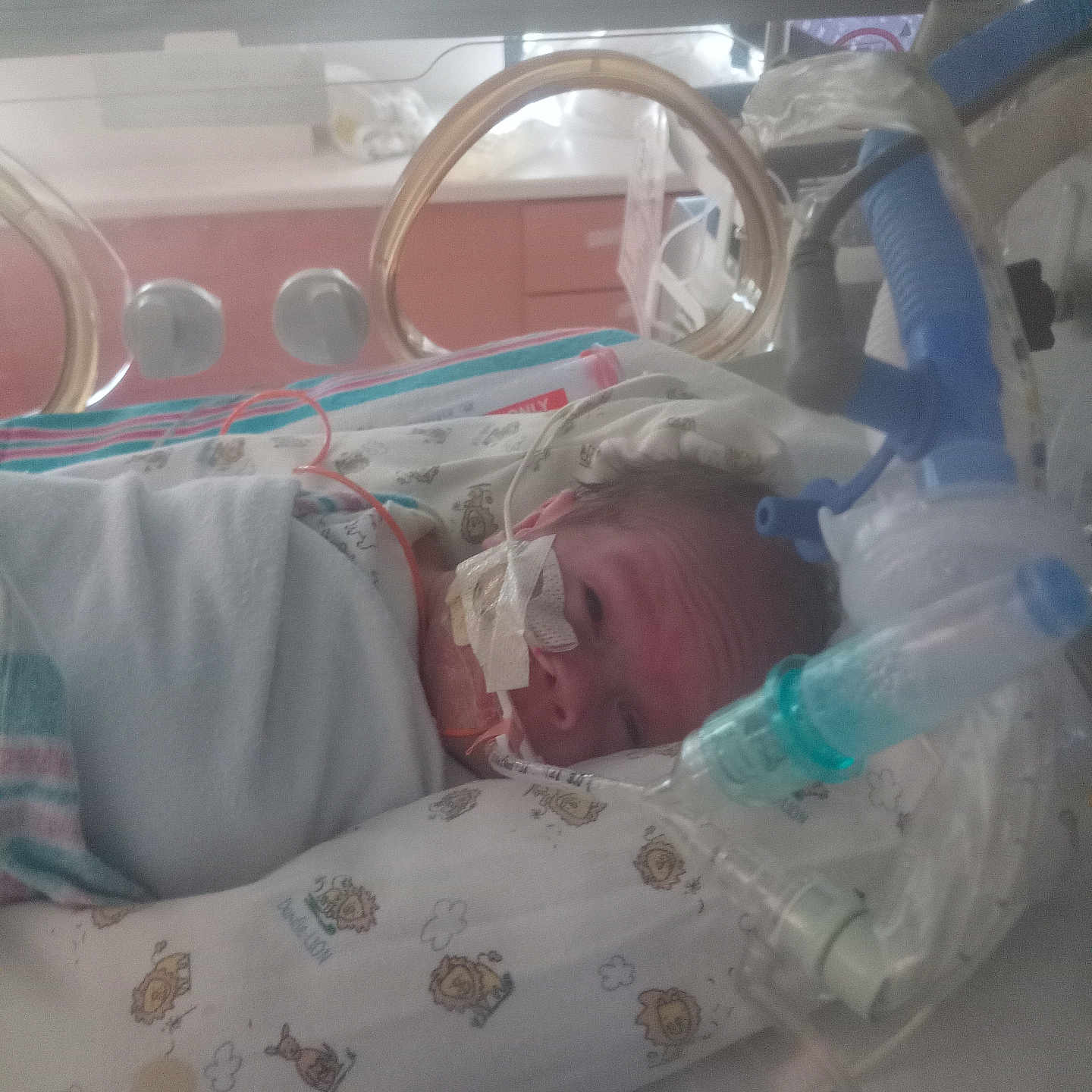 Elijah is registered to the contest to win money with this photo: architecture, baby, bed, blanket, building, clinic, clothing, cradle, crib, face, furniture, glove, head, hospital, infantbed, newborn, operatingtheatre, person, photography, portrait