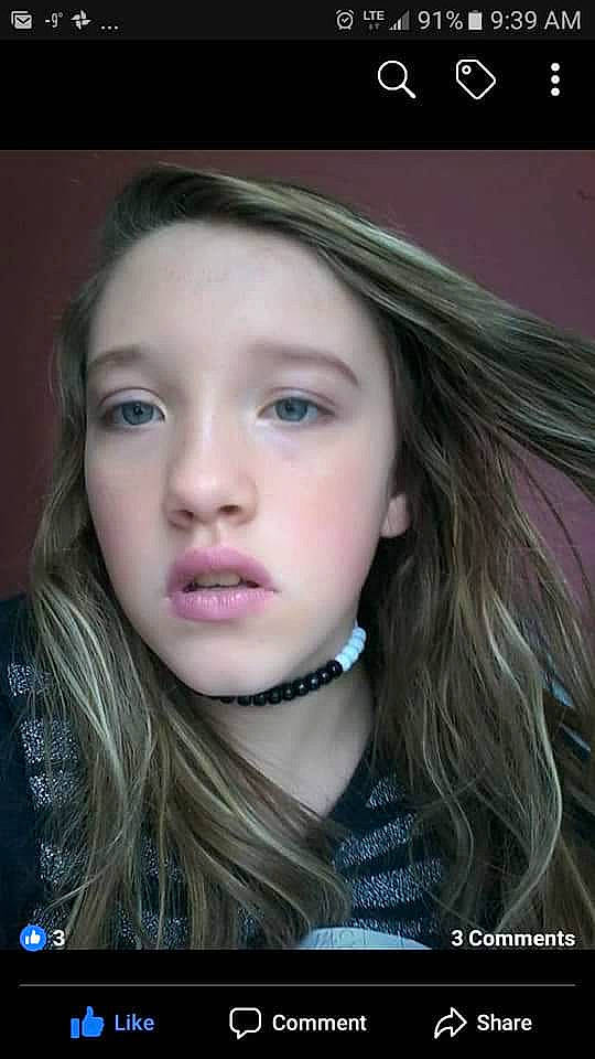 Kyleigh-jade joined the competition — help win amazing prizes! beauty, blond, brown_hair, cheek, chin, eye, eyebrow, eyelash, face, forehead, hair, hair_coloring, hairstyle, head, jaw, lip, long_hair, nose, person, selfie