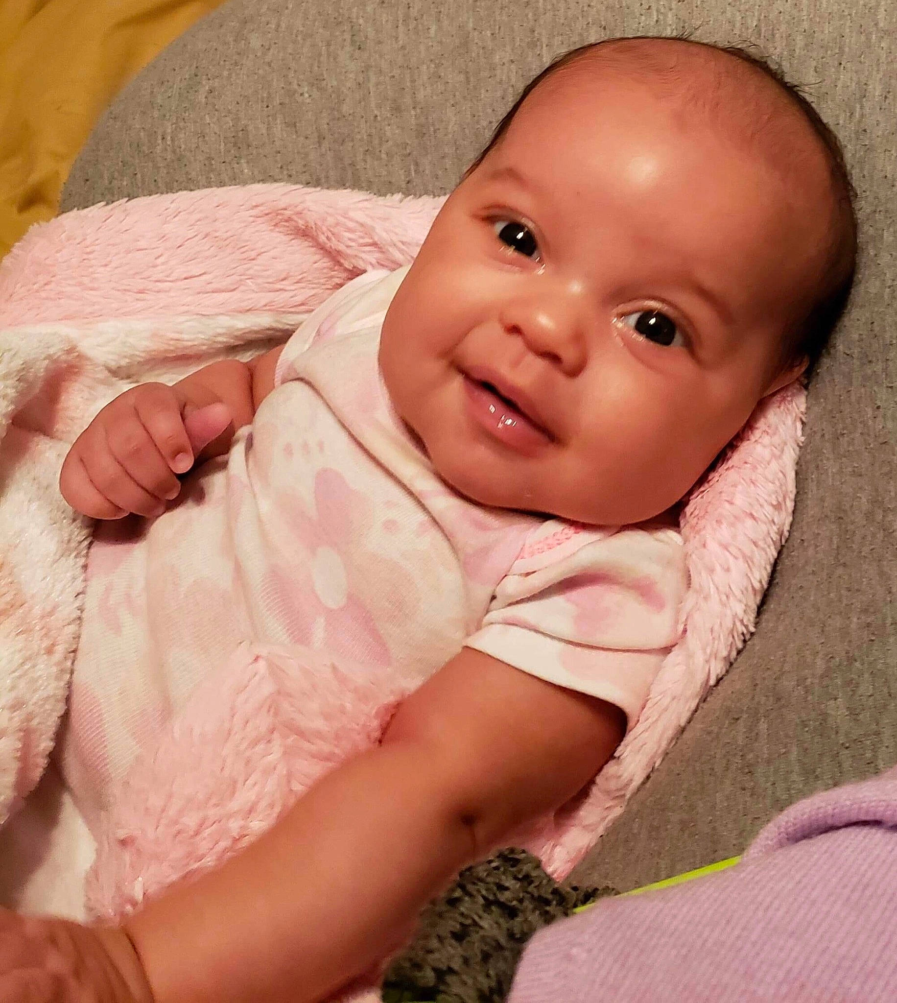 Nakya joined the competition — help win amazing prizes! baby, cheek, child, chin, eye, face, head, iris, lip, mouth, nose, person, pink, skin, smile, toddler