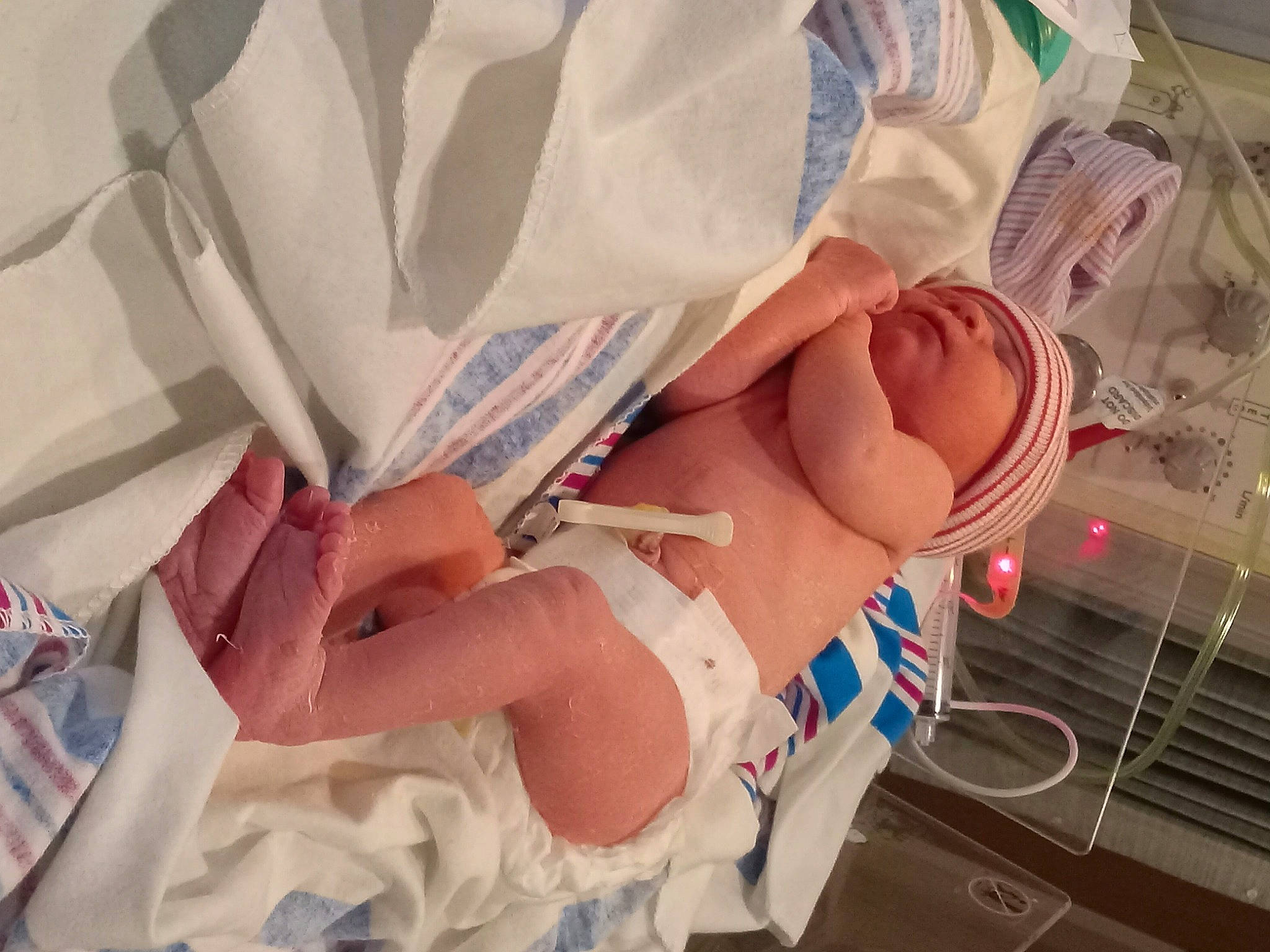 Atreyu joined the competition — help win amazing prizes! arm, baby, carmine, child, comfort, eyelash, finger, flesh, hand, hat, human_leg, linens, mouth, nail, person, pink, room, skin, textile, thumb