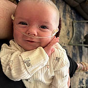 Ryatt is registered to the contest to win money with this photo: baby, infant, smile, face, person, oxygen_tube, medical, onesie, animal_prints, hand, arm, indoor, carpet, furniture, living_room, cozy, closeup, cute, healthy, child