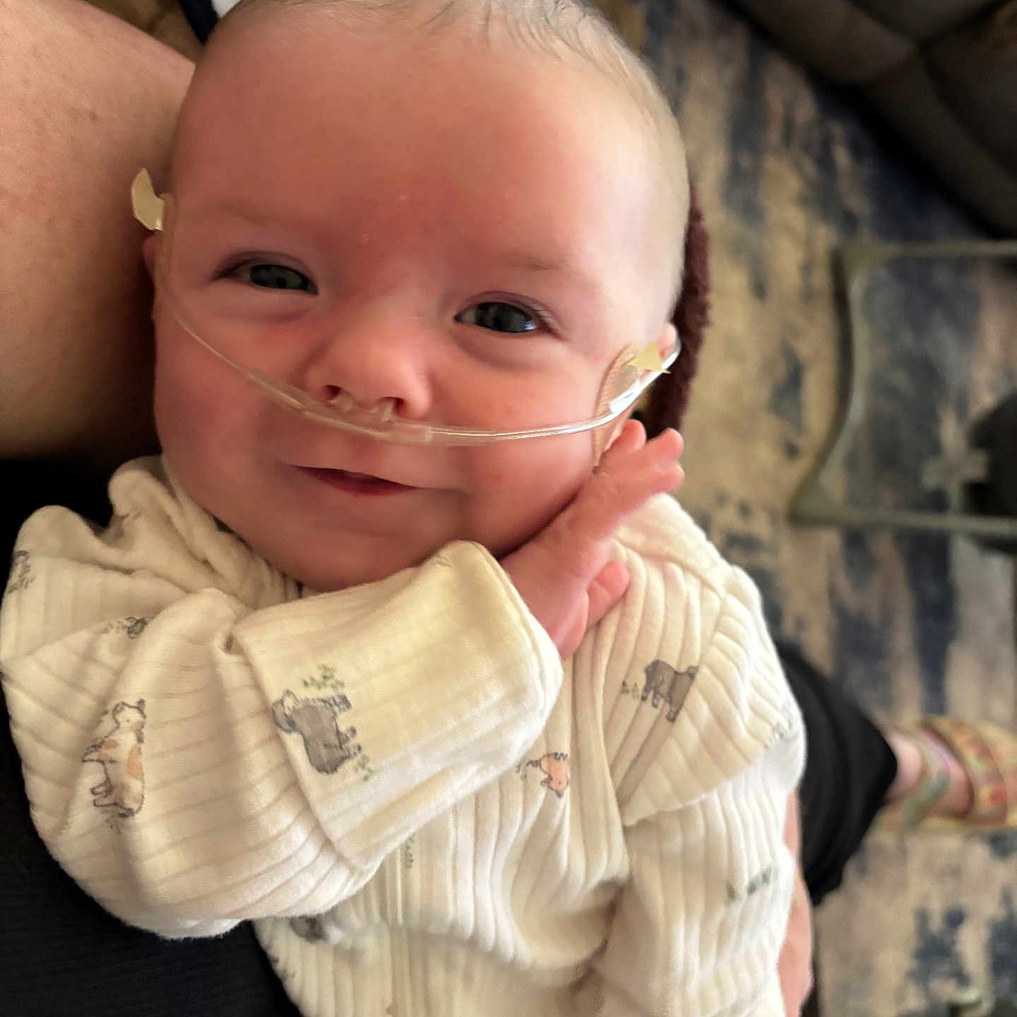 Ryatt is registered to the contest to win money with this photo: baby, infant, smile, face, person, oxygen_tube, medical, onesie, animal_prints, hand, arm, indoor, carpet, furniture, living_room, cozy, closeup, cute, healthy, child