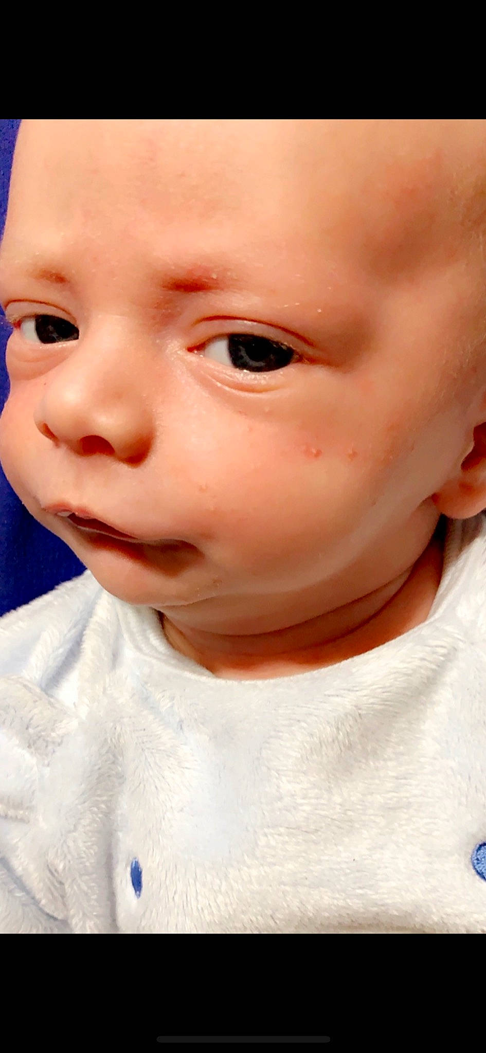 Kooper joined the competition — help win amazing prizes! baby, cheek, child, chin, close_up, ear, eye, eyebrow, eyelash, face, forehead, head, jaw, lip, mouth, neck, nose, person, portrait_photography, skin