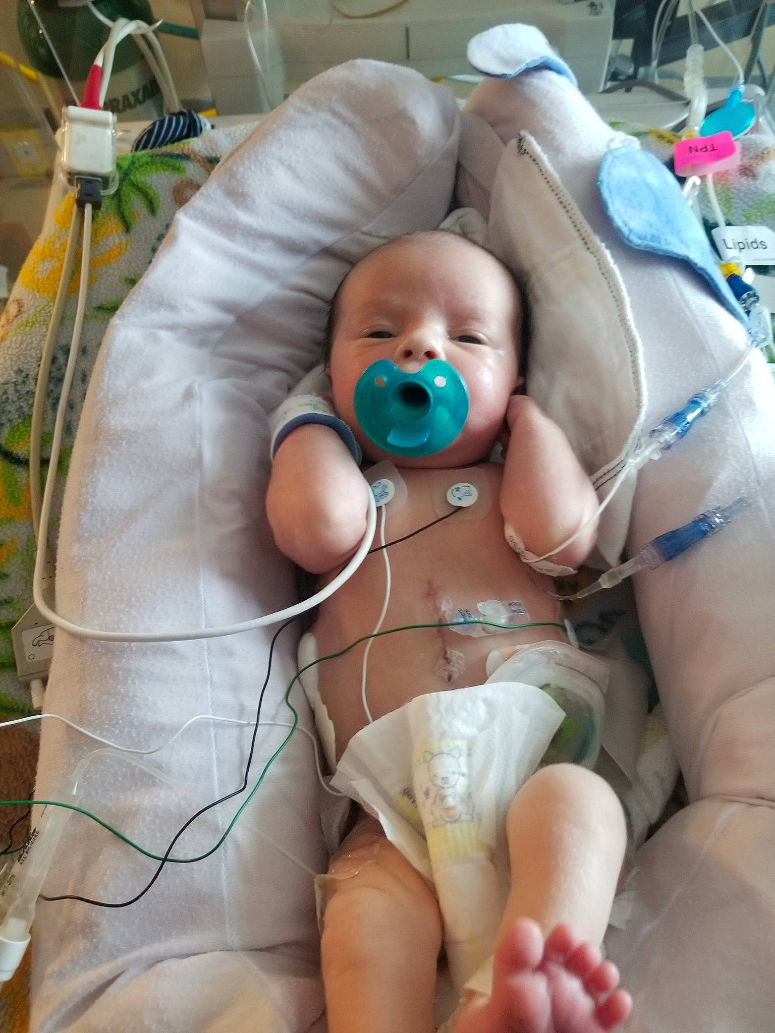 Kannon joined the competition — help win amazing prizes! abdomen, baby, baby_products, chest, child, comfort, health_care, hospital, knee, linens, medical, medical_equipment, medical_procedure, patient, person, service, skin, thigh, thumb, toddler