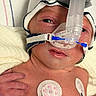 Hunter is registered to the contest to win money with this photo: newborn, baby, medical_mask, hospital, infant, sensor, hand, blanket, skin, face, healthcare, patient, neonatal, care, respirator, closeup, fragile, tender, premature, monitoring