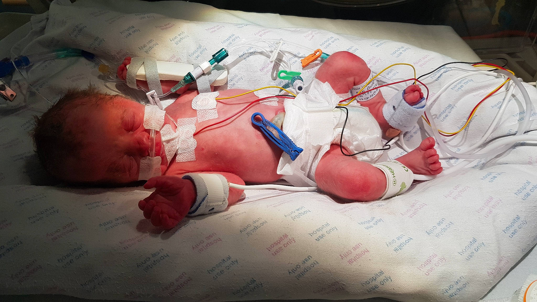 Cayden is registered to the contest to win money with this photo: abdomen, baby, baby_sleeping, bedding, carmine, chest, child, comfort, diaper, elbow, event, flesh, human_leg, knee, linens, mouth, person, room, thigh, toddler