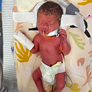 Eliana joined the competition — help win amazing prizes! newborn, baby, infant, medical_tubes, hospital, diaper, cushion, pattern, skin, face, hand, foot, bed, bandage, lying_down, healthcare, premature, person, closeup, fragile