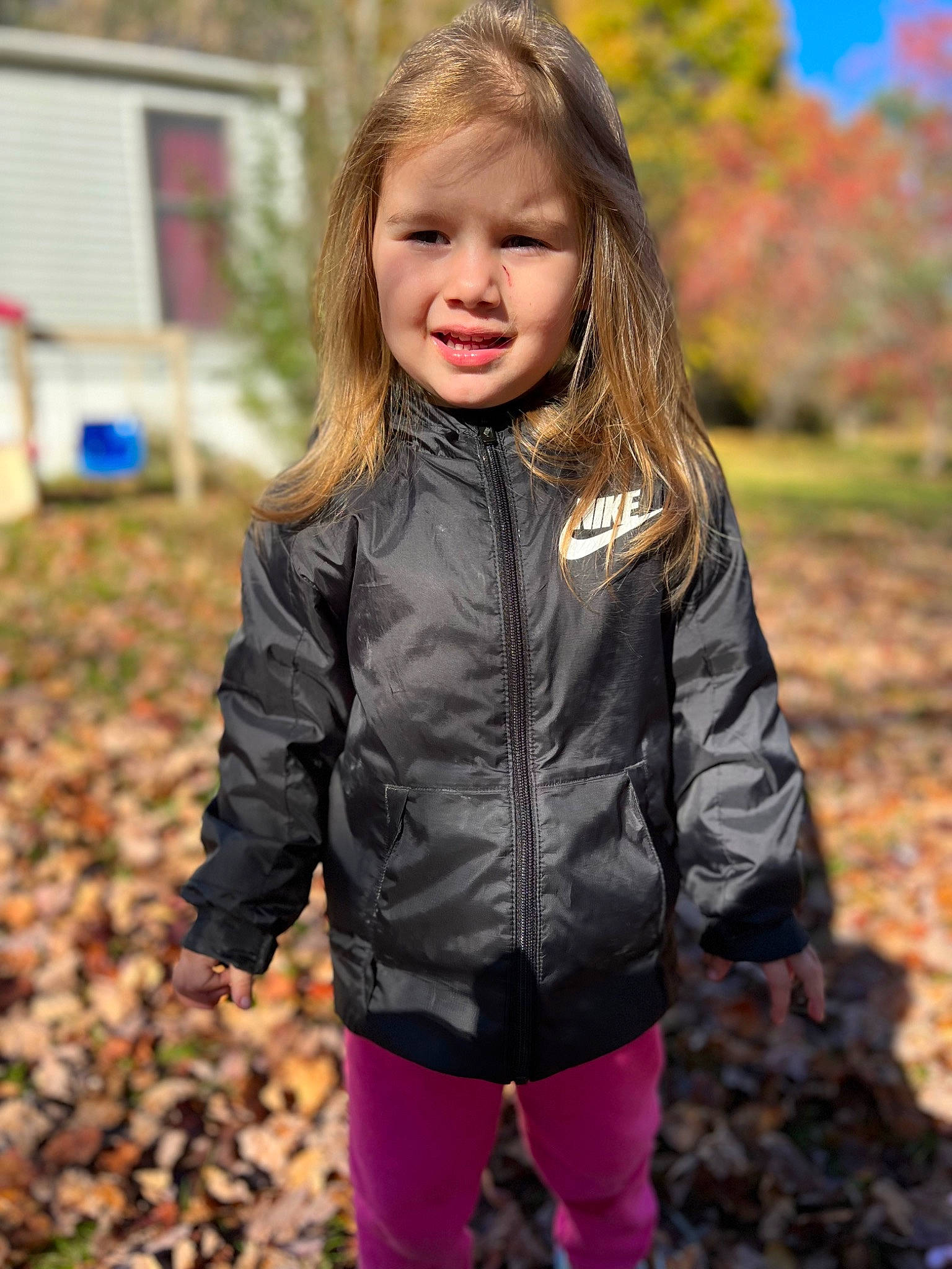 Emily joined the competition — help win amazing prizes! eye, face, flash_photography, grass, hair, hairstyle, happy, head, iris, jacket, outerwear, people_in_nature, person, plant, sleeve, smile, street_fashion, t_shirt, toddler, tree