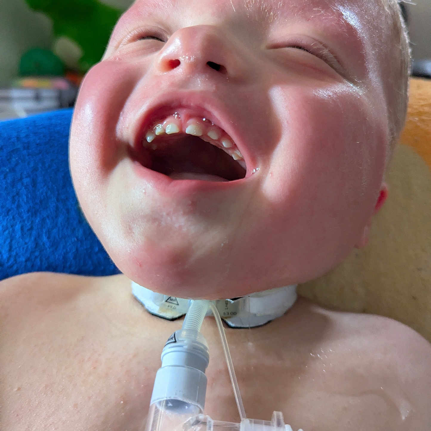 Bryant joined the competition — help win amazing prizes! child, baby, smiling, laughing, face, medical_device, tracheostomy, tube, close_up, skin, toy, dinosaur, blue_blanket, indoor, happy, expression, healthcare, young, person, head