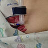 Nash is registered to the contest to win money with this photo: baby, blanket, care, child, closeup, hand, hat, healthcare, hospital, human, infant, mask, medical_equipment, nasal_cannula, newborn, person, premature, resting, skin, tenderness