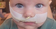 Sawyer joined the competition — help win amazing prizes! baby, infant, child, portrait, close_up, face, eyes, wide_eyed, serious, medical_dressing, bandage, green_clothing, indoor, home, sitting, camera, head, bald, blurred_background, photography