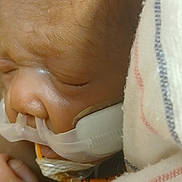 Hazel joined the competition — help win amazing prizes! newborn, baby, infant, hospital, nasal_cannula, sleeping, blanket, closeup, face, skin, hand, medical_device, patient, swaddled, child, healthcare, resting, cute, fragile, portrait