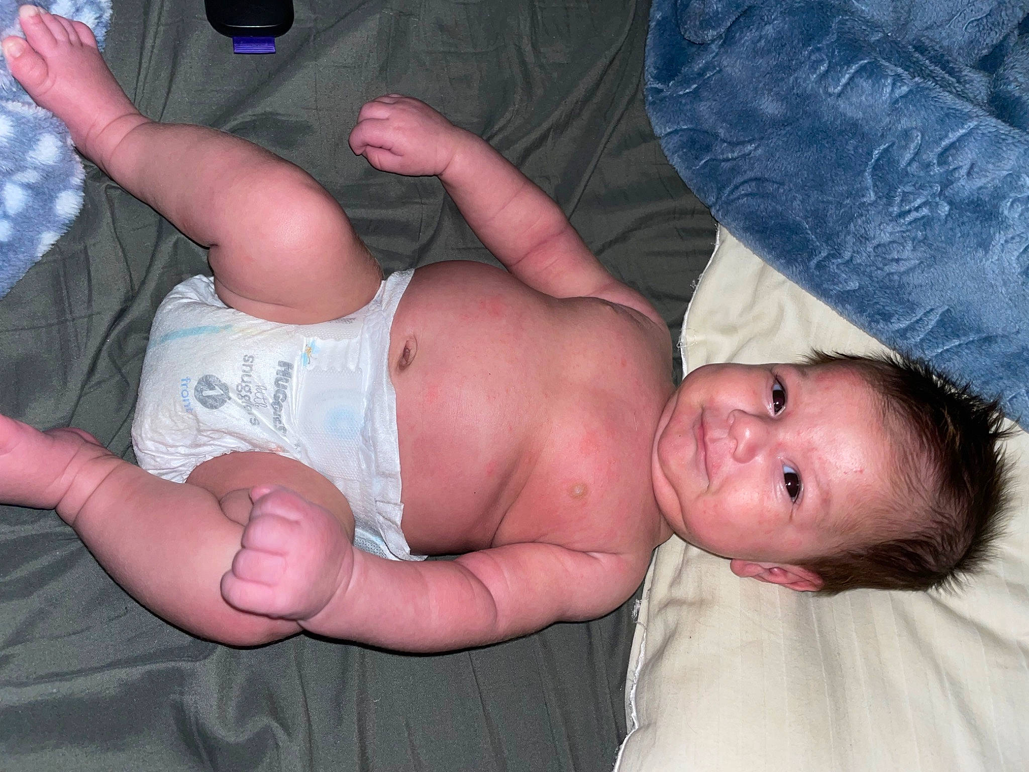 Kylan joined the competition — help win amazing prizes! abdomen, baby, cheek, chest, comfort, elbow, finger, gesture, hand, head, human_body, joint, leg, mouth, muscle, person, skin, stomach, thumb, toddler