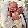 newborn, baby, infant, medical, hospital, incubator, monitoring_wires, diaper, towel, patches, face, hand, lying_down, cute, skin, healthcare, patient, premature, care, tiny