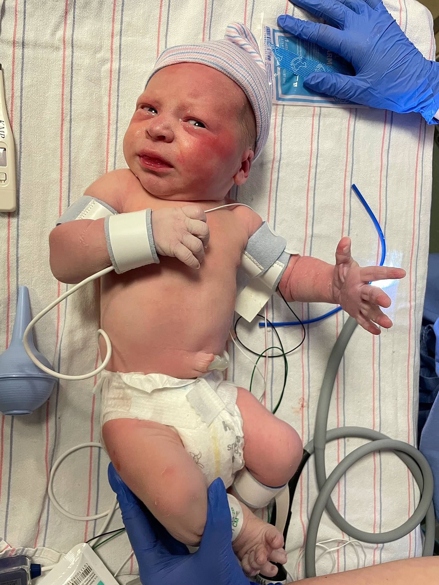 Luke joined the competition — help win amazing prizes! abdomen, baby, baby_toddler_clothing, blue, chest, comfort, diaper, eyelash, finger, hand, headwear, human_body, joint, mouth, muscle, person, shoulder, stomach, thigh, thumb