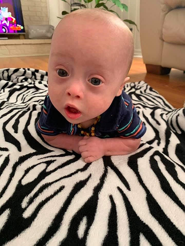 Kaisyn is registered to the contest to win money with this photo: baby, cheek, child, ear, eye, face, head, mouth, nose, person, skin, surprise, toddler, tummy_time