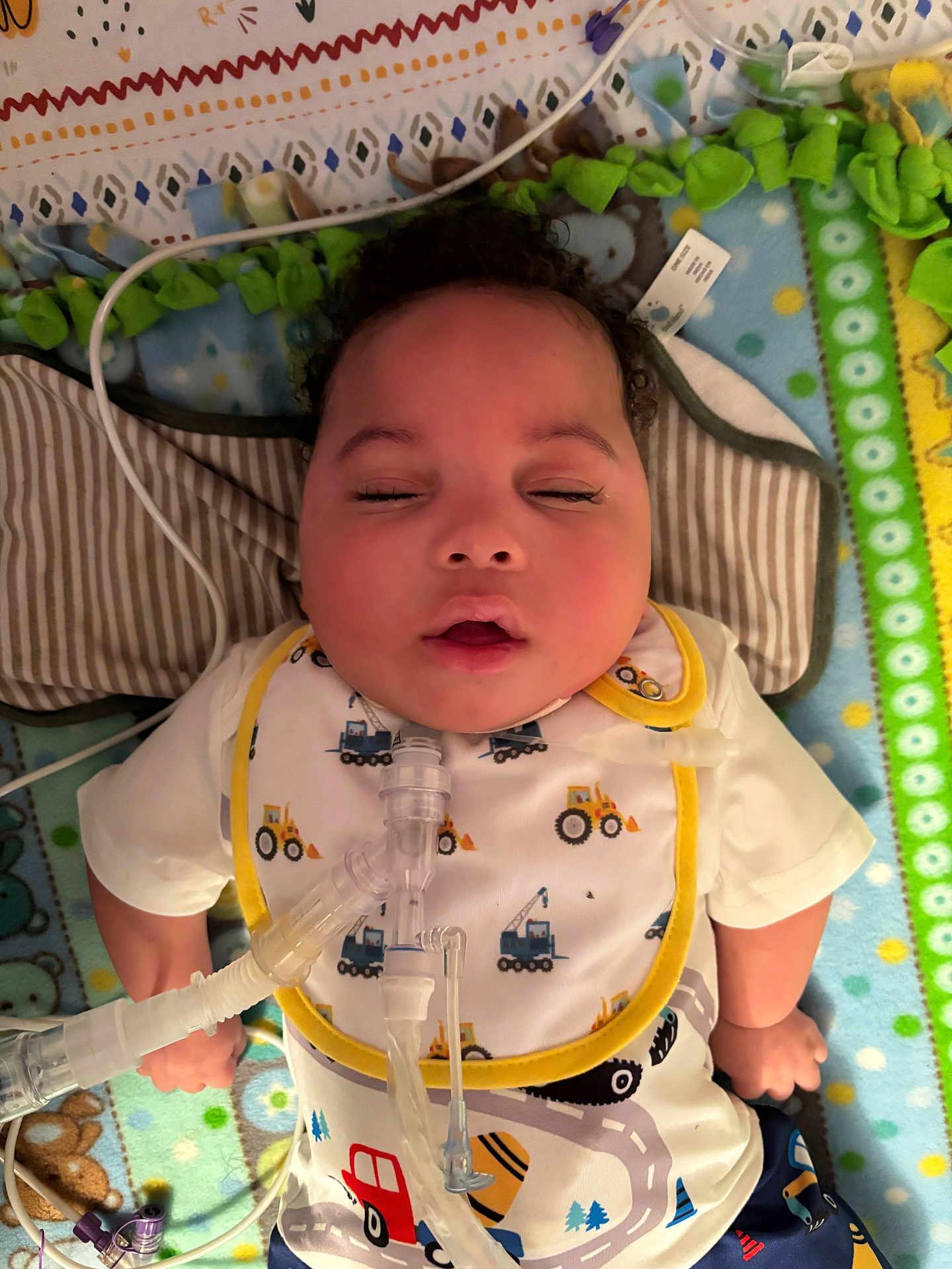 Jeremy is registered to the contest to win money with this photo: baby, infant, sleeping, face, bib, medical_tube, play_mat, colorful, clothing, child, closeup, indoor, healthcare, cute, peaceful, lying_down, young_child, toy_pattern, comfort, resting