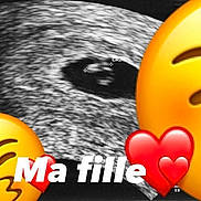 Louna participe au concours pour gagner de l'argent avec cette photo : art, automotive_tire, carmine, circle, close_up, facial_expression, fictional_character, font, fur, happy, headgear, logo, mammal, organism, personal_protective_equipment, photo_caption, rock, snout, toy, vertebrate