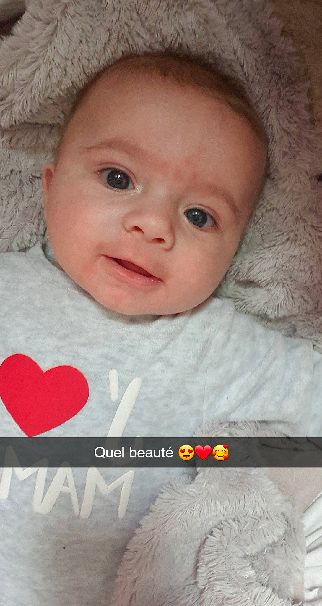 Marvyn participe au concours pour gagner de l'argent avec cette photo : baby, baby_toddler_clothing, cheek, chin, eye, eyebrow, face, flash_photography, human_body, iris, lip, mouth, nose, organ, outerwear, person, photograph, product, skin, sleeve