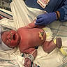 June is registered to the contest to win money with this photo: newborn, baby, hospital, nurse, gloves, medical_tube, hat, diaper, bed, blanket, monitoring_band, umbilical_cord, infant, person, healthcare, care, clinic, medical, patient, tender_moment