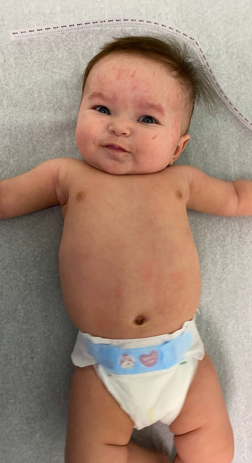 Ivelisse is registered to the contest to win money with this photo: arm, baby, cheek, chest, eye, finger, hair, head, human_body, iris, lip, mouth, muscle, neck, organ, person, skin, stomach, thigh, thumb