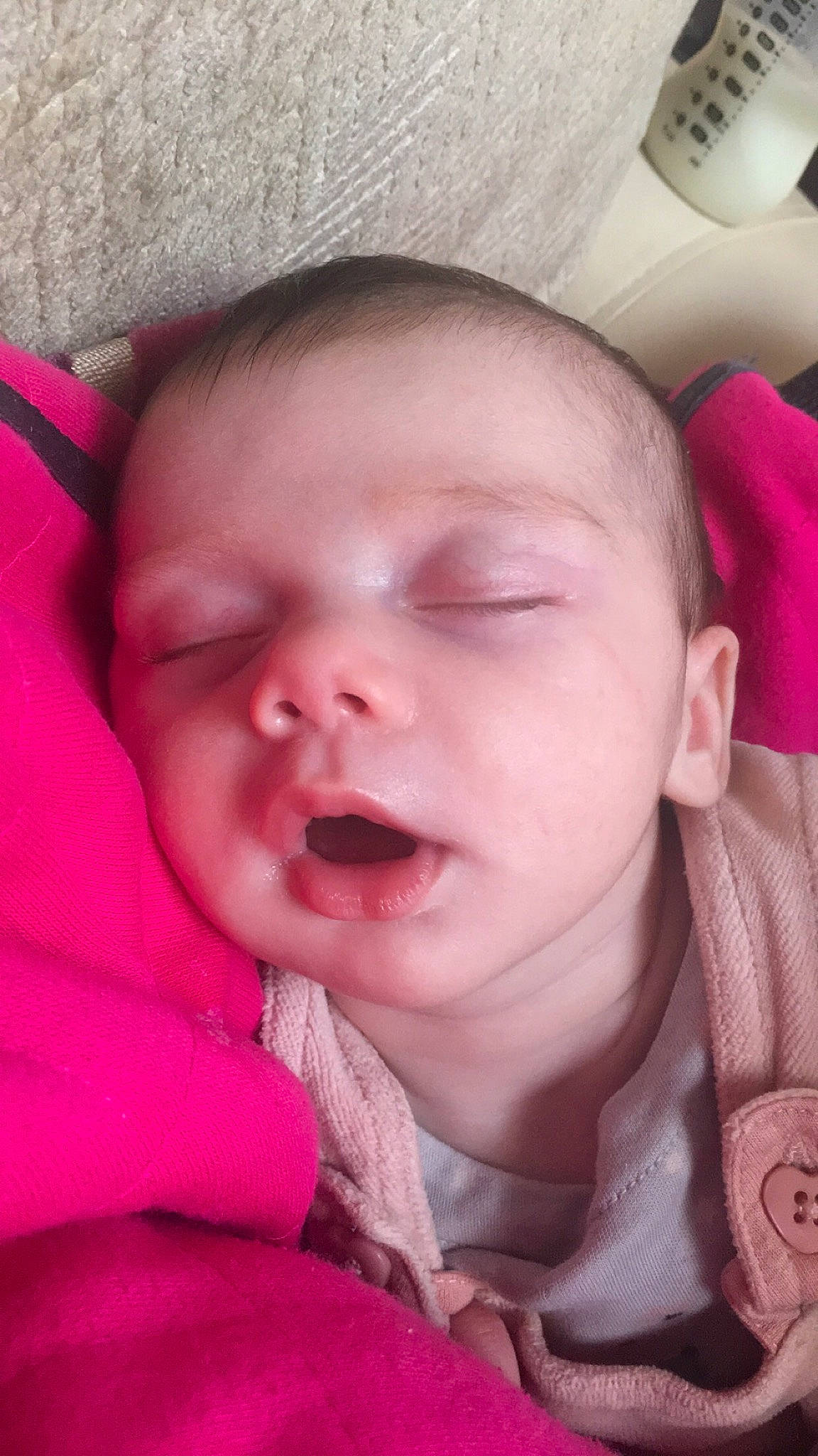 Esme joined the competition — help win amazing prizes! baby, cheek, chin, comfort, ear, eye, eyebrow, eyelash, facial_expression, forehead, human_body, iris, jaw, lip, mouth, neck, nose, person, pink, skin