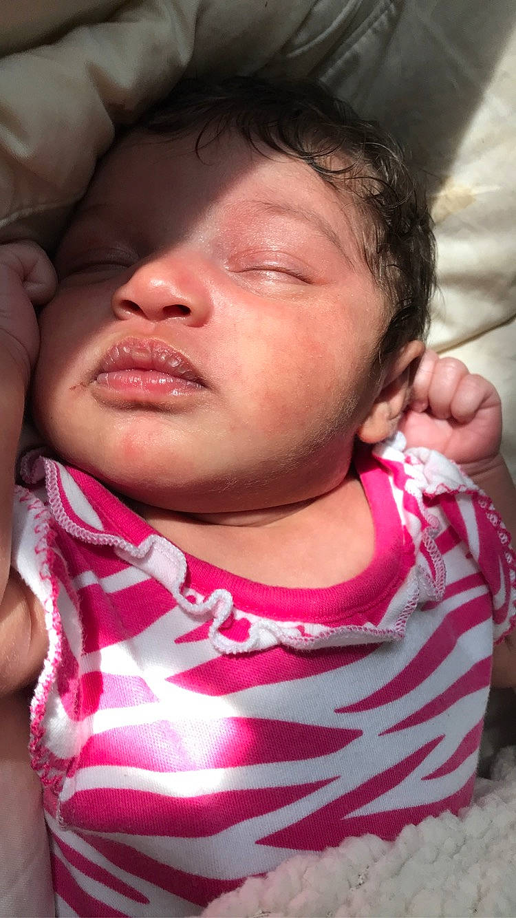 Blessyn is registered to the contest to win money with this photo: baby, cheek, child, chin, ear, face, facial_expression, forehead, gesture, head, lip, mouth, neck, nose, person, pink, skin, sleep, smile, toddler