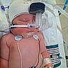 baby, bed, cap, child, healthcare, hospital, hospital_bed, infant, iv_line, medical_care, medical_equipment, medical_tape, monitor_pads, monitoring_wires, nasal_cannula, newborn, patient, skin, sleeping, towel