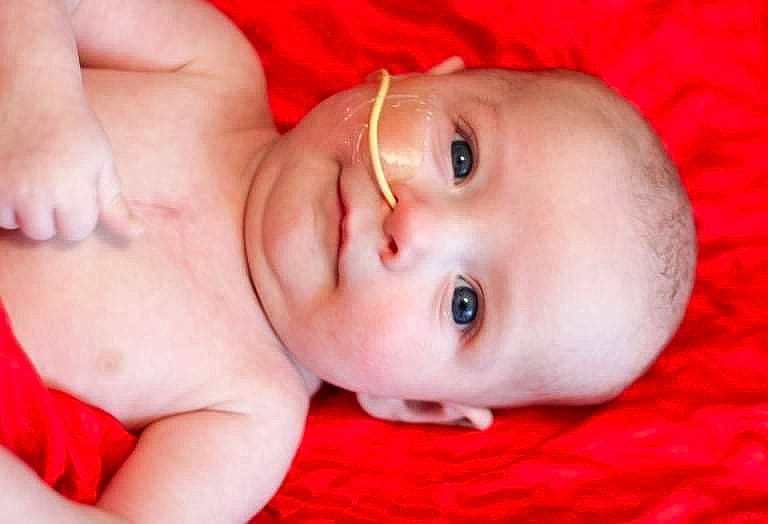 Ezio joined the competition — help win amazing prizes! baby, cheek, chin, eye, eyebrow, eyelash, face, facial_expression, finger, head, human_body, iris, lip, mammal, mouth, nose, person, pink, skin, smile