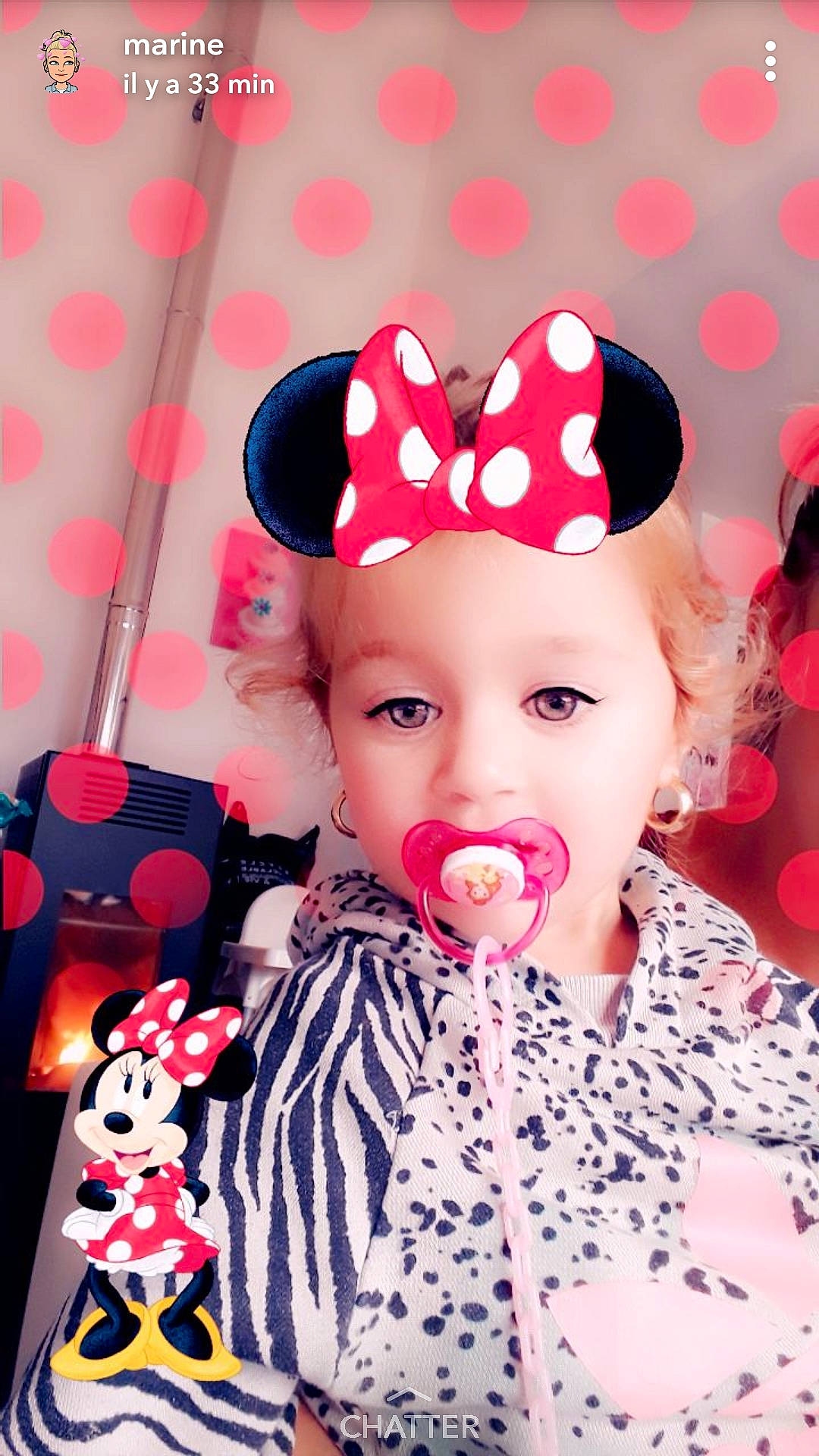 Daisya participe au concours pour gagner de l'argent avec cette photo : cheek, child, design, fun, girl, hair_accessory, happiness, headwear, infant, lip, nose, pattern, person, pink, polka_dot, product, skin, smile, toddler