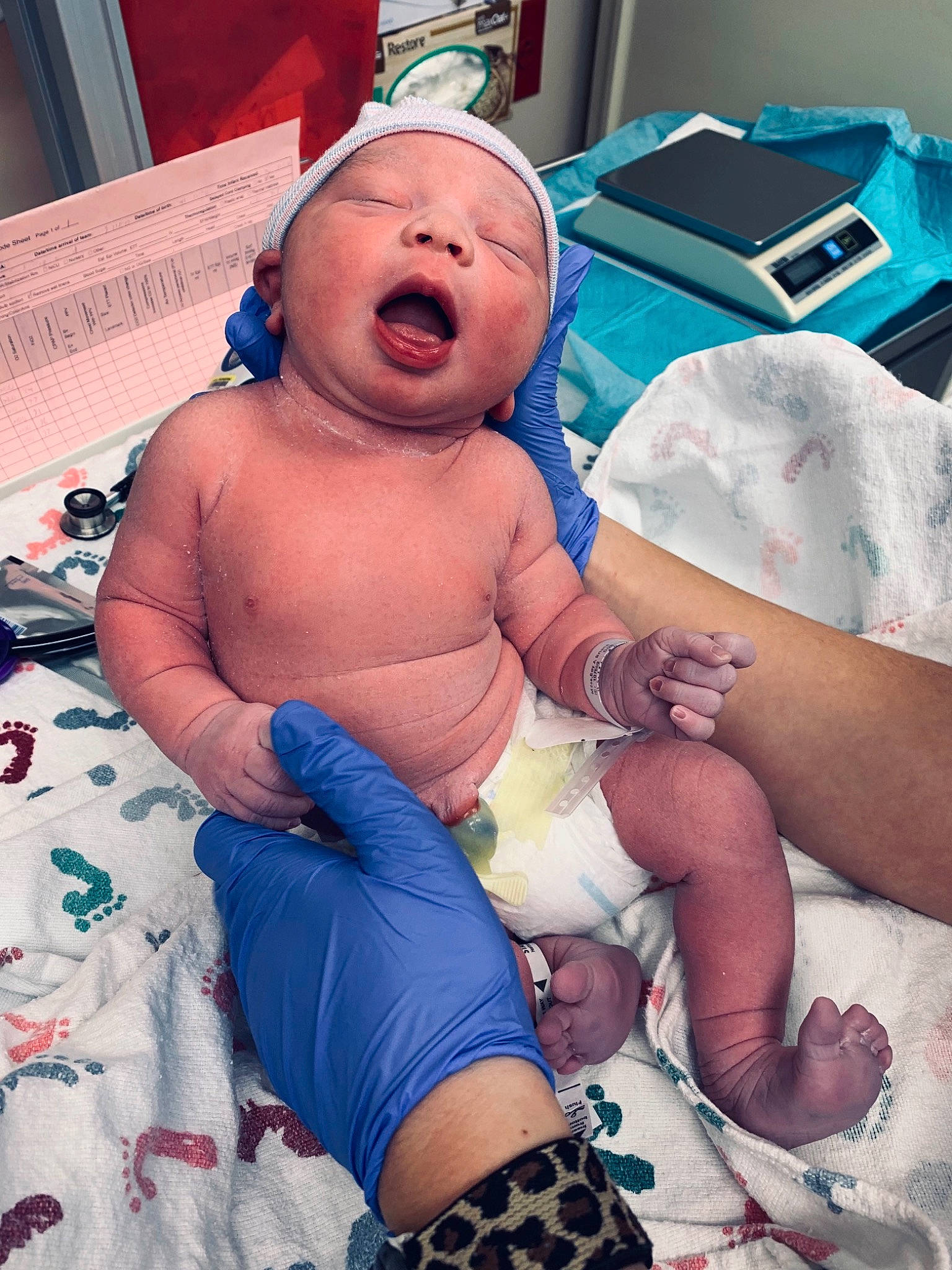 Dee joined the competition — help win amazing prizes! arm, azure, baby, blue, comfort, face, facial_expression, finger, hat, human, human_body, joint, leg, mouth, muscle, organ, person, pink, skin, stomach