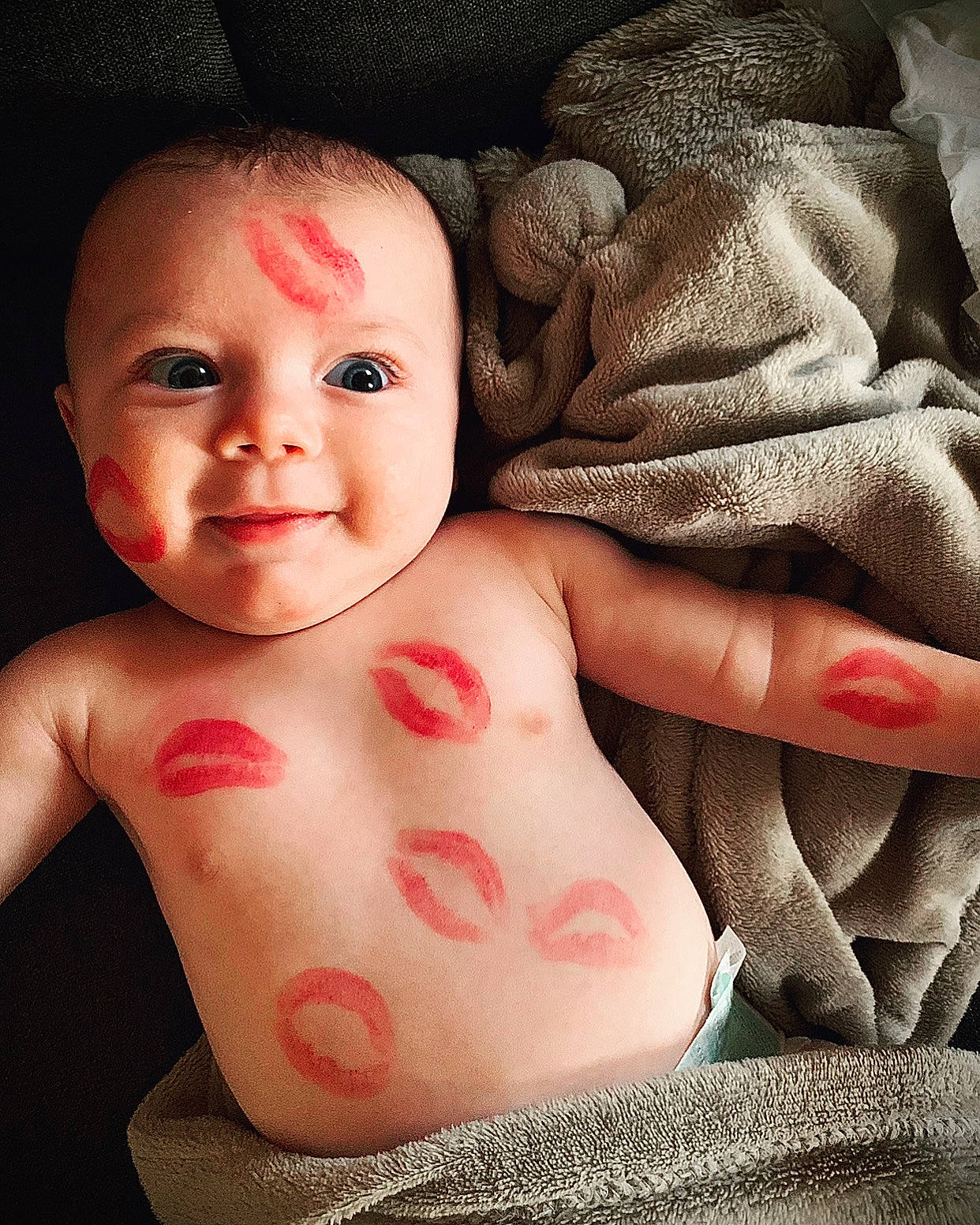 Brewenn a rejoint le concours — aidez-le/la à gagner de superbes lots ! arm, baby, cheek, chin, comfort, eye, eyebrow, facial_expression, hand, human, human_body, lip, mouth, muscle, neck, nose, person, skin, smile, stomach