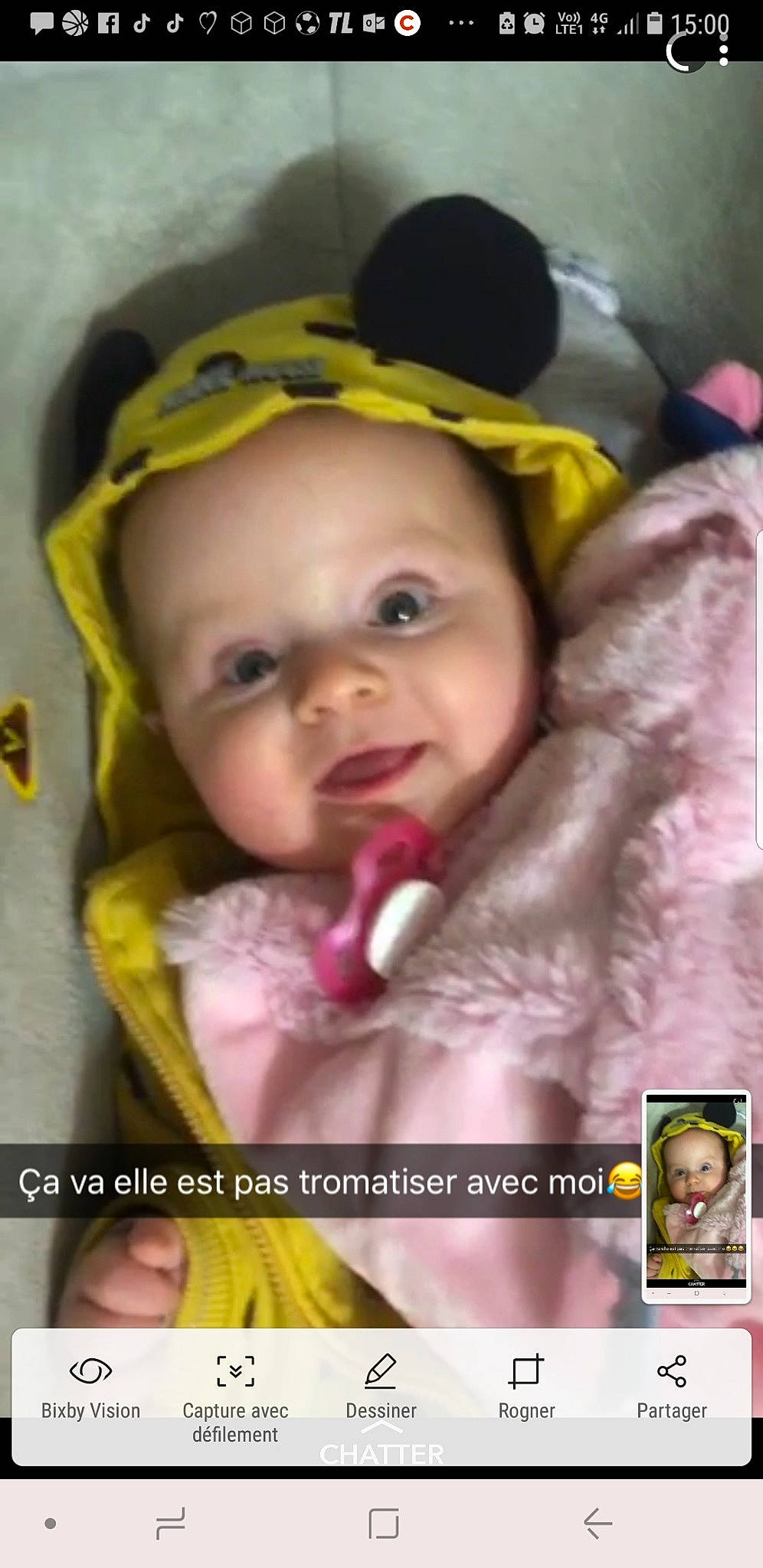 Maellys participe au concours pour gagner de l'argent avec cette photo : cheek, child, chin, face, forehead, girl, head, lip, mouth, nose, person, photo_caption, product, screenshot, selfie, toddler