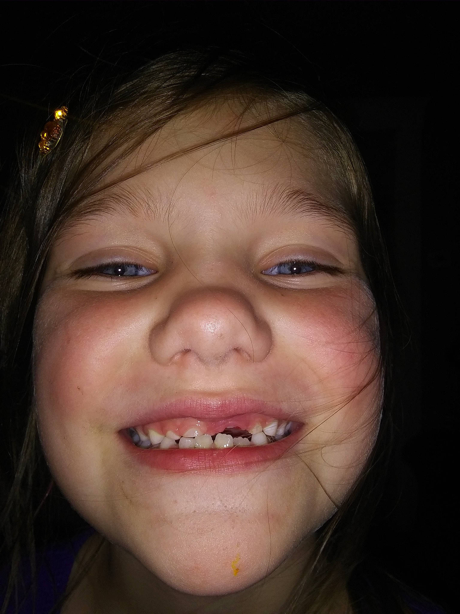 Emilee joined the competition — help win amazing prizes! cheek, chin, close_up, eyebrow, face, facial_expression, forehead, fun, head, human_body, jaw, joy, laugh, lip, mouth, nose, organ, person, skin, smile