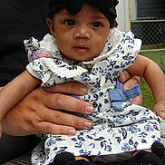 Charity is registered to the contest to win money with this photo: baby, child, infant, dress, headband, black_bow, socks, kiss_baby, hand, adult_hand, outdoor, wooden_surface, curious, face, person, cute, clothing, portrait, sitting, garden