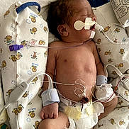 Riley is registered to the contest to win money with this photo: newborn, baby, infant, hospital, medical_equipment, incubator, bassinet, sleeping, face, portrait, diaper, monitoring, tubes, nasal_cannula, electrodes, hospital_bedding, blanket, healthcare, premature_infant, indoors